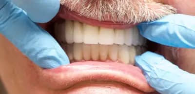 Smile Dental Services