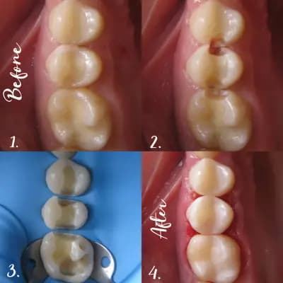 Дентална клиника ЗЪБОРАН - Zaboran dental clinic