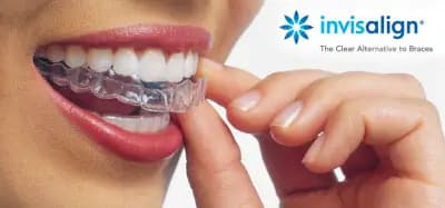 Д-р Ставрева, ортодонтско лечение с алайнери Invisalign