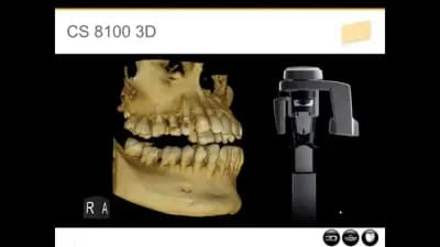 Дентален 3D рентген-СИТИ Стара Загора-Зъбни снимки,Рентгенова лаборатория