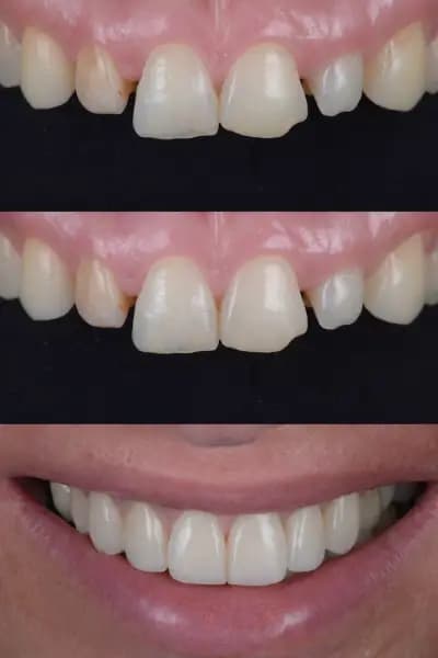 Дентална практика - DENTACARE