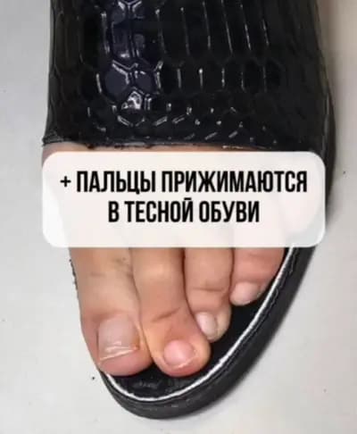 Бистра Гинева, терапевтичен педикюр, подолог, маникюр, козметика