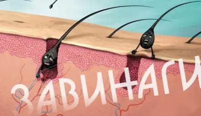 Д-р Анелия Якимова / Дерматолог, Естетични процедури, Филъри, Ботокс