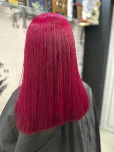 Scandall Beauty Studio І Ботокс І Подчертаване на скули І Запълване на бръчки І Корекция на носа