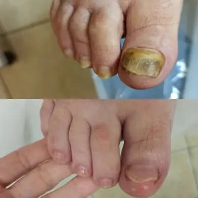 Подолог Анжелика Стрелкова - студио терапевтичен педикюр в Бургас