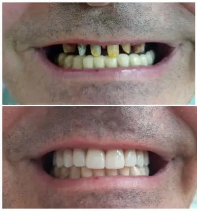 Dental Tourism in Bulgaria