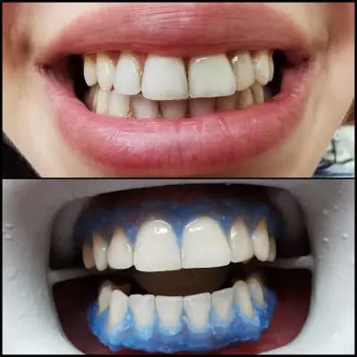 Dental Tourism in Bulgaria