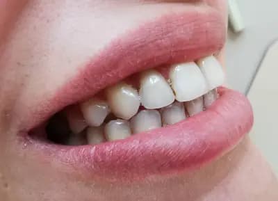 Dental Tourism in Bulgaria