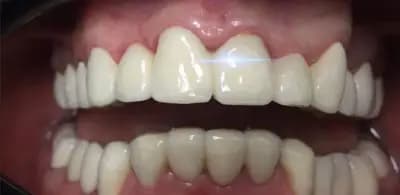 Dental Tourism in Bulgaria