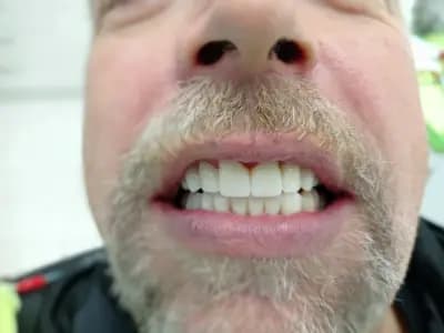 Dental Tourism in Bulgaria