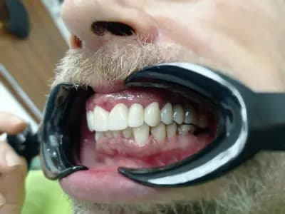 Dental Tourism in Bulgaria