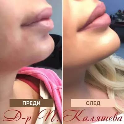 Dr. Petrana Kaliasheva (Д-р Петрана Каляшева)