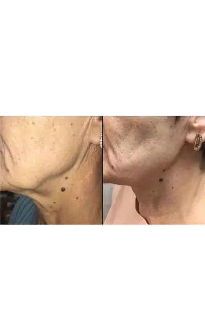Body correction Varna 2