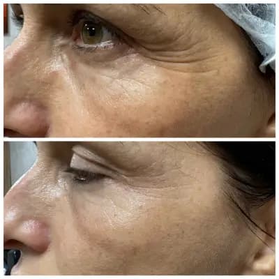 Body correction Varna 2