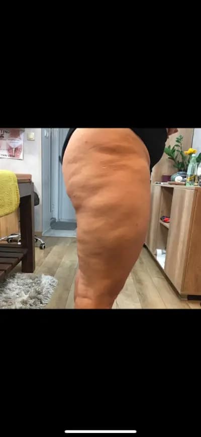 Body correction Varna 2