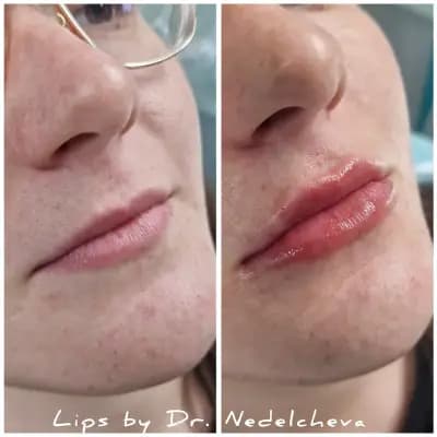 Dr. Nedelcheva - дерматология и естетика