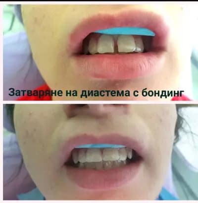Д-р Кирил Балуков - Зъболекар
